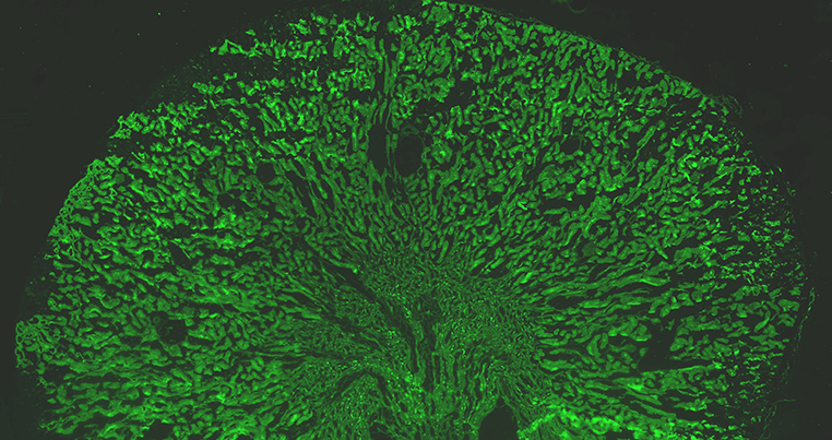 Expression of the V-ATPase 