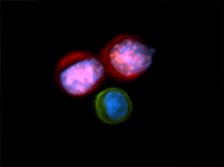 Circulating tumor cells Image courtesy of Min Yu, MD, PhD
