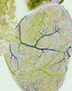 Coronary vasculature in zebrafish (Image courtesy of Children’s Hospital Los Angeles)