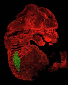 Transgenic mouse model used to target lung mesenchymal cells