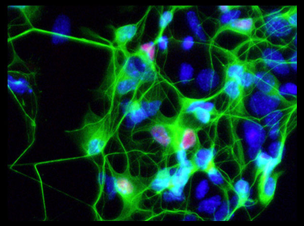 Motor neurons derived from a patient with ALS (Image courtesy of the Ichida Lab)