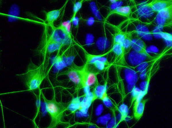 Motor neurons derived from an ALS patient (Image courtesy of the Ichida Lab)