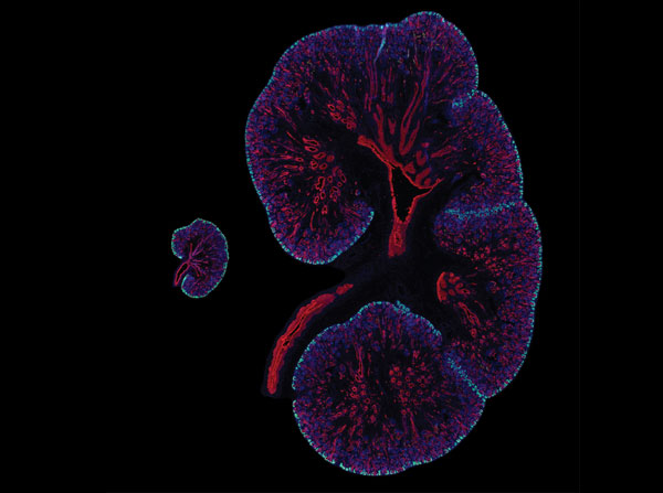 Embryonic day 15.5 mouse kidney next to a 15.5 week human fetal kidney with SIX2 (cyan) marking the nephron progenitor cells. The collecting duct system is red, and nuclei are in blue. (Image by Lori O’Brien)