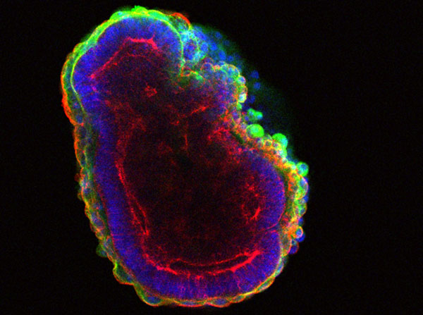 Stem cells self-organize to form a hollow ball of cells. (Image by In Kyoung Mah and Francesca Mariani)