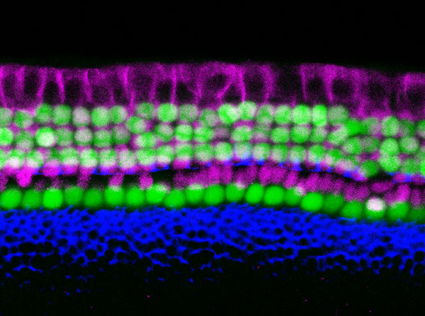 The organ of Corti, the hearing organ of the inner ear, is made up of a single row of inner hair cells and three rows of outer hair cells (green), surrounded by supporting cells (purple). (Image by Yassan Abdolazimi and Neil Segil)