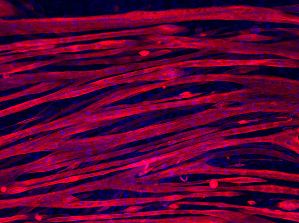 Skeletal myotubes grown for three weeks on gelatin hydrogel (Image by Archana Bettadapur, Gio Suh, Evelyn Wang, Holly Huber, Alyssa Viscio and Megan McCain)