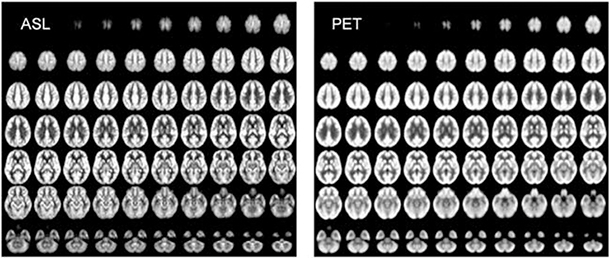 Leader in brain imaging joins USC Stevens Neuroimaging and Informatics Institute