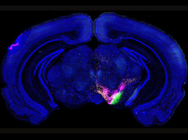 To understand how information is communicated throughout the brain, the mouse connectome project (MCP) uses multiple fluorescent-labeled dyes to trace the connections among all identified structures of the mouse brain. The dyes get injected into specific brain structures and get transported to target structures that are connected with the injection site. This image is one 50 micrometer-thick section of the mouse brain that contains labeling from three dyes injected into three different brain structures, indicating the unique connections of each injection.