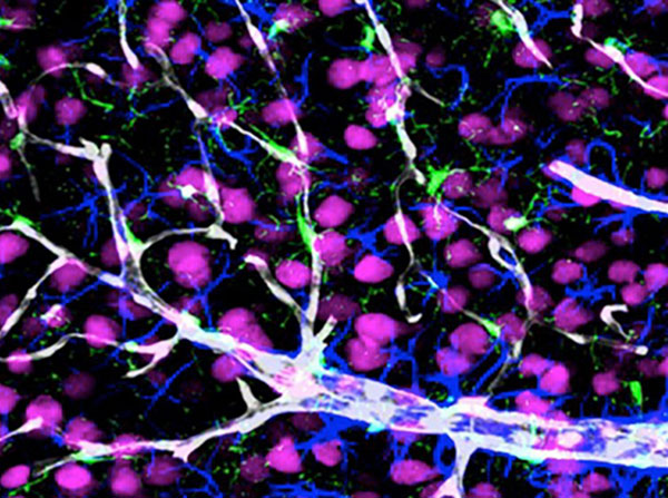 A snapshot of the blood-brain barrier, a gatekeeper that prevents toxic substances from entering the brain.