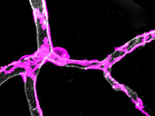 Pericytes, or gatekeeper cells, are wrapped around capillaries in the cortex of a mouse brain. (Amy Nelson/Keck School of Medicine of USC)