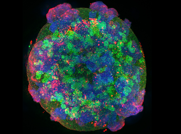 Kidney organoid (Image by Tracy Tran/McMcMahon Lab)