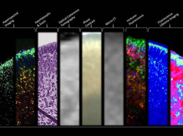 Breakthrough research on stem cell-derived retinal organoid imaging offers real-time insights into the developmental origins of blinding eye diseases