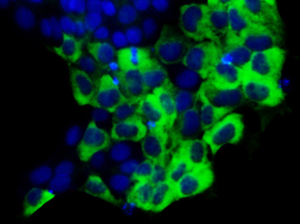 The protein TAZ sends “mixed signals” to stem cells