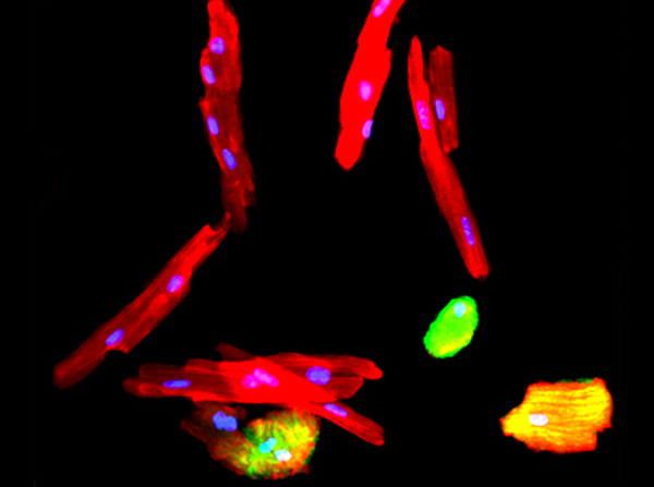 single cell prep