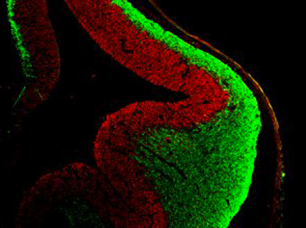 Coronal section of embryonic mouse cortex