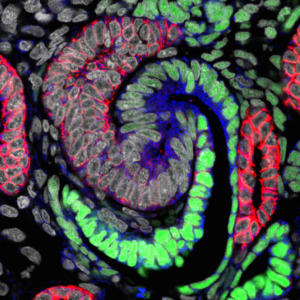 At an early stage, a nephron forming in the human kidney generates an S-shaped structure. Green cells will generate the kidneys’ filtering device, and blue and red cells specialized regions responsible for distinct nephron activities.