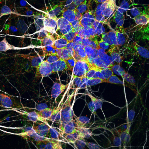 Motor nerve cells