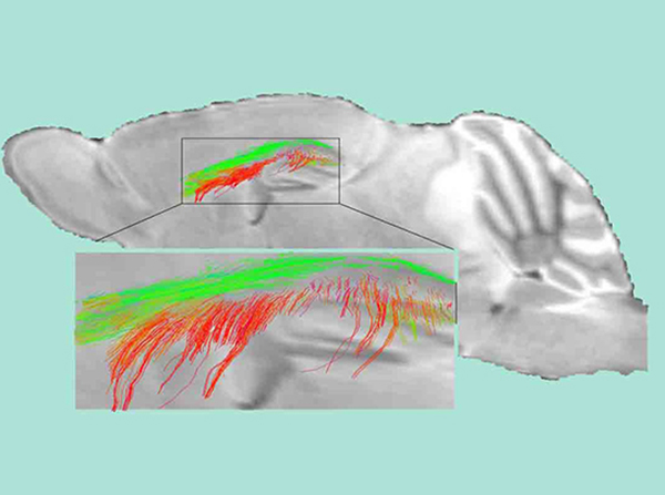 Diffusion MRI maps show disrupted white matter connectivity and loss of white matter fiber tracts in 1-year-old pericyte-deficient mice. (Image/Berislav Zlokovic Lab)