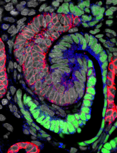 CCL21-488 WT1-555 CDH1-647 HUMAN WK16 IMAGED 1FEB2018_S Body