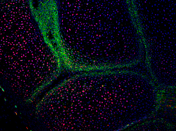 A developing metacarpal joint with skeletal stem cells (green) and mature cartilage cells (red). (Image/Courtesy of Evseenko Lab)