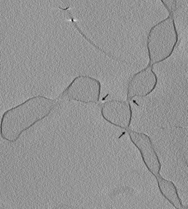 branced-bacterial-membrane-cryotomography-768x856