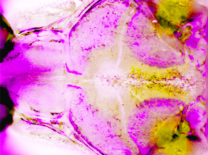 Zebrafish make waves in our understanding of a common craniofacial birth defect