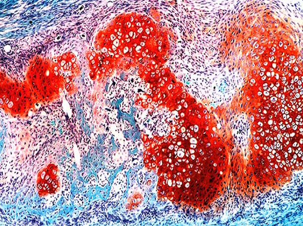 Messenger cells offer new insights into bone healing