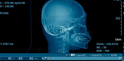 USC researchers receive $12.5 million grant for craniofacial research data-sharing endeavor