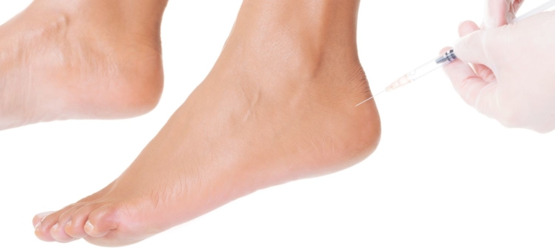 New Injection Techniques for Treating Chronic Foot Pain