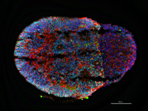 organoid