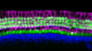 USC Stem Cell scientists find a simpler way to make sensory hearing cells