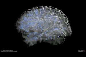 Mapping changes in a mysterious brain structure throughout the lifespan