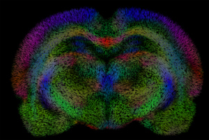 Funding backs a new generation of tools for computational neuroimaging