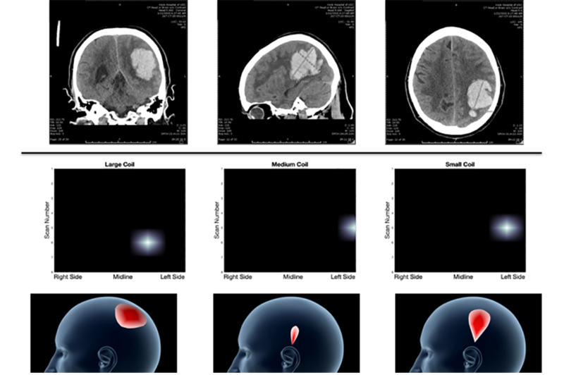 New, portable device aims to quickly diagnose patients with bleeding in brain