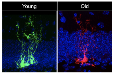 Do our brains age faster than the rest of our bodies?