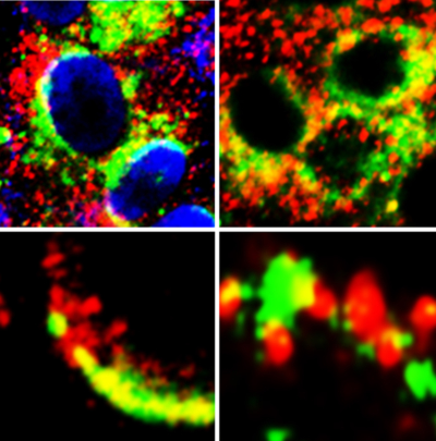 KSOM study reveals potential new treatment target in the fight against COVID-19