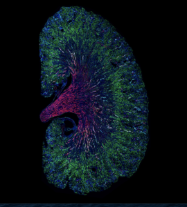 The same cell type can help or hinder repair after acute kidney injury