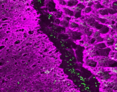 The early postnatal coronal suture contains stem cells (green) that separate and grow the neighboring bones (magenta)