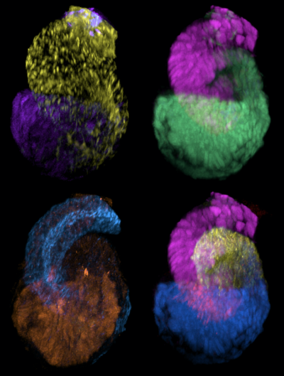 USC-led study traces the blueprints for how human kidneys form their filtering units