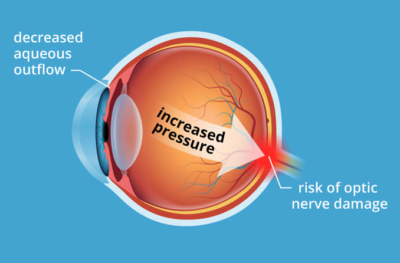 When blindness attacks: How research and cutting-edge clinical techniques saved a woman’s sight