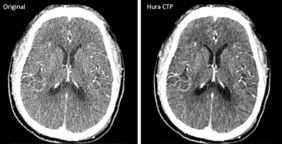 Keck School researchers hit FDA clearance milestone for CT software