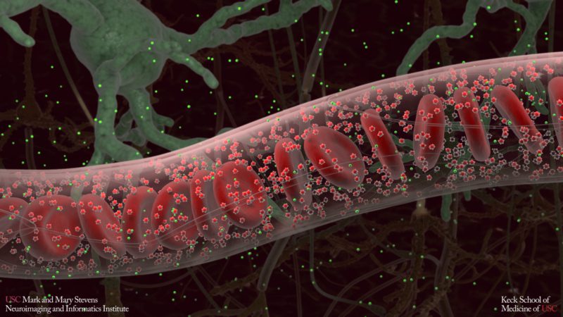 Blood vessels in the brain (Credit: Stevens INI)