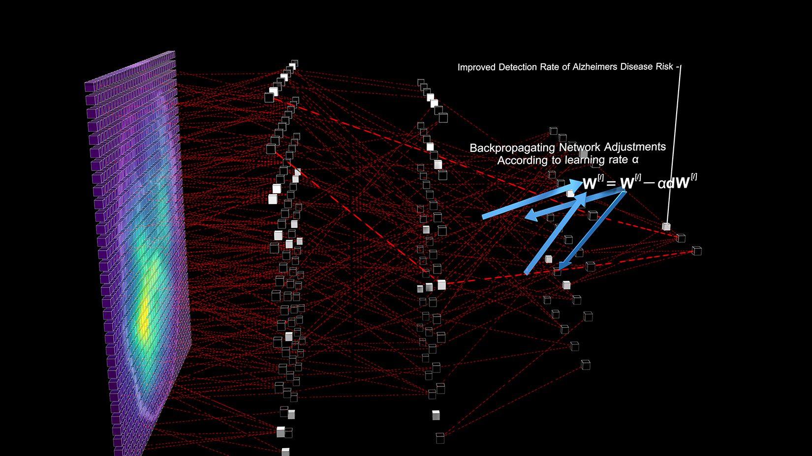 Illustration of a machine learning network used in neuroimaging.