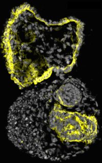 Human cystic organoid (Image by Cheng (Photo: Jack Song/McMahon Lab)