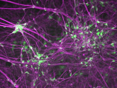 Human induced motor neurons. Motor neurons are green, and neurons are purple. (Image courtesy of the Ichida Lab)