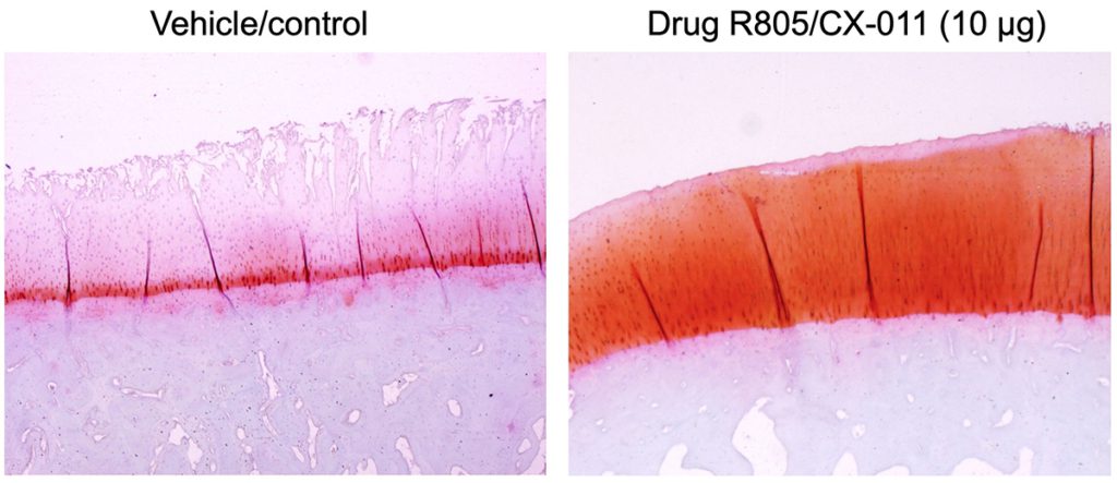 The image on the left shows damaged osteoarthritic cartilage without treatment in animal studies, and the image on the right shows regeneration of articular cartilage after knee injection of the new drug R805/CX-011. (Image: Evseenko Lab/USC Stem Cell)