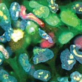 image of Patient-derived-neural-stem-cells-by-Eric-Hendricks