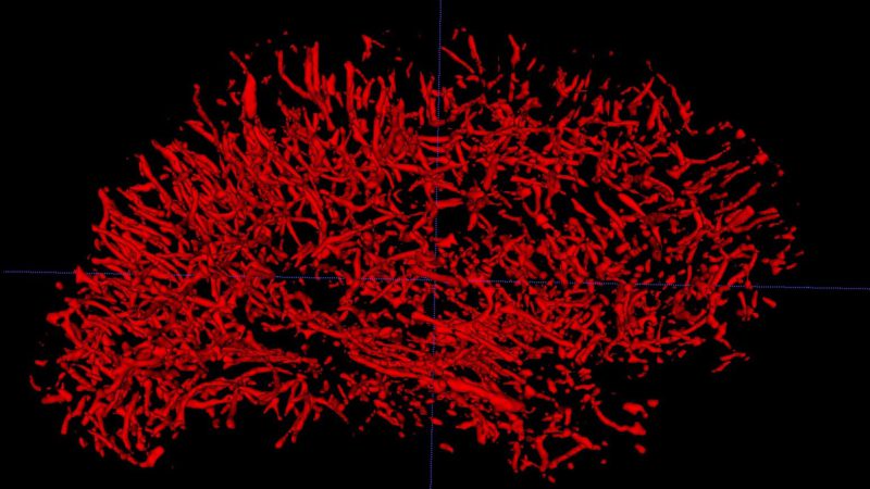 3D-rendering of whole brain cerebral small vessels from a healthy volunteer acquired in 8 minutes. Photo credit: USC Stevens INI